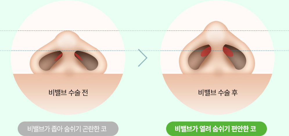 이미지명