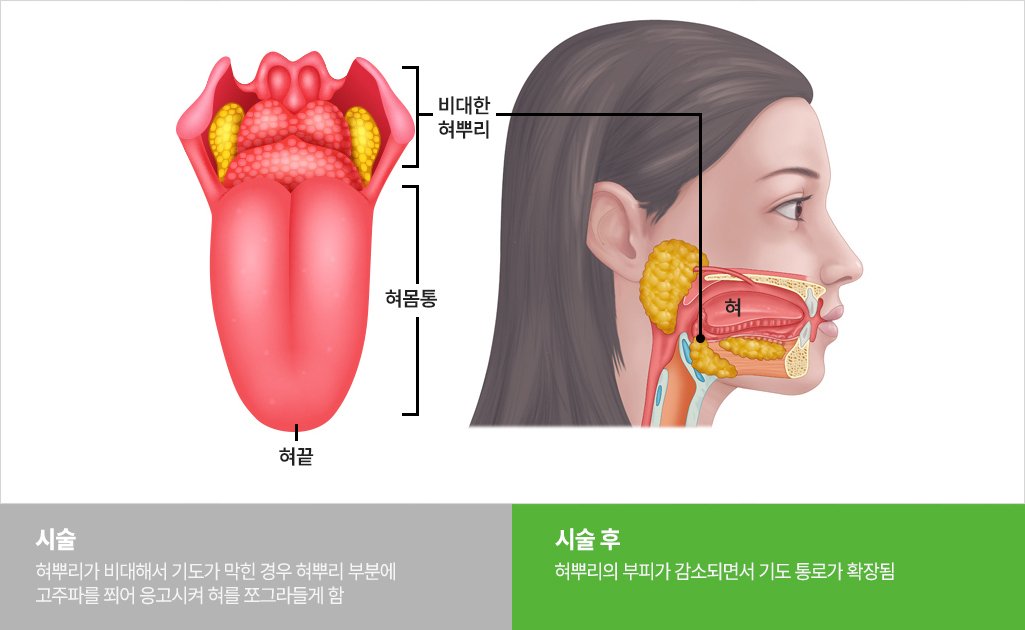 이미지명